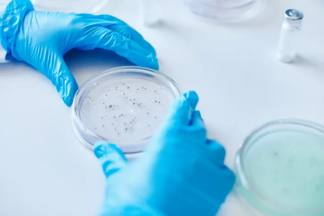 Gloved hands holding a Petri dish with bacterial colonies